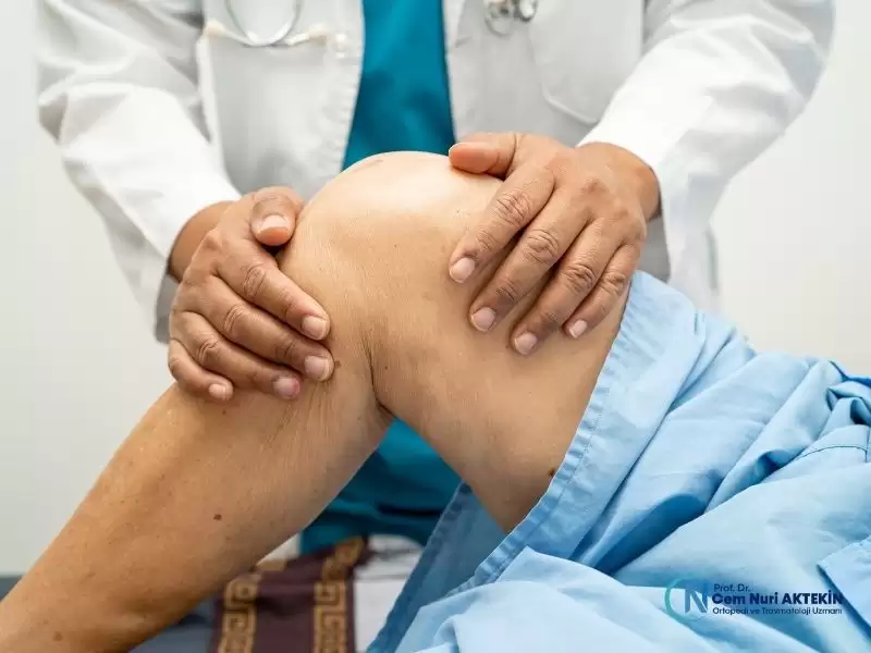 dizde-kireclenme-artrit