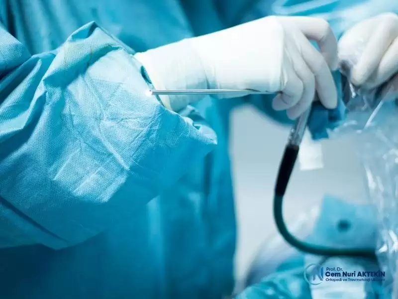 omuz-artroskopisi