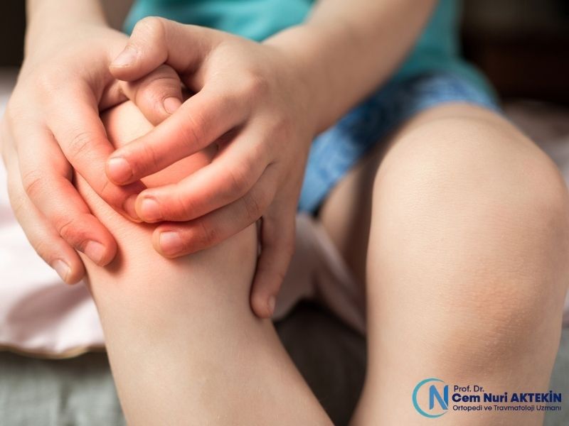 cocuklarda-on-capraz-bag-kopmasinin-belirtileri