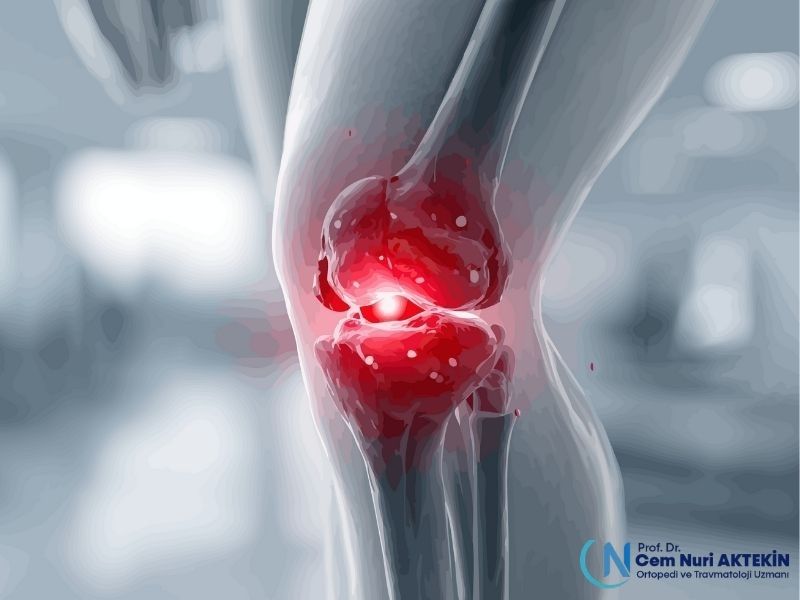 diz-kikirdagi-neden-onemlidir