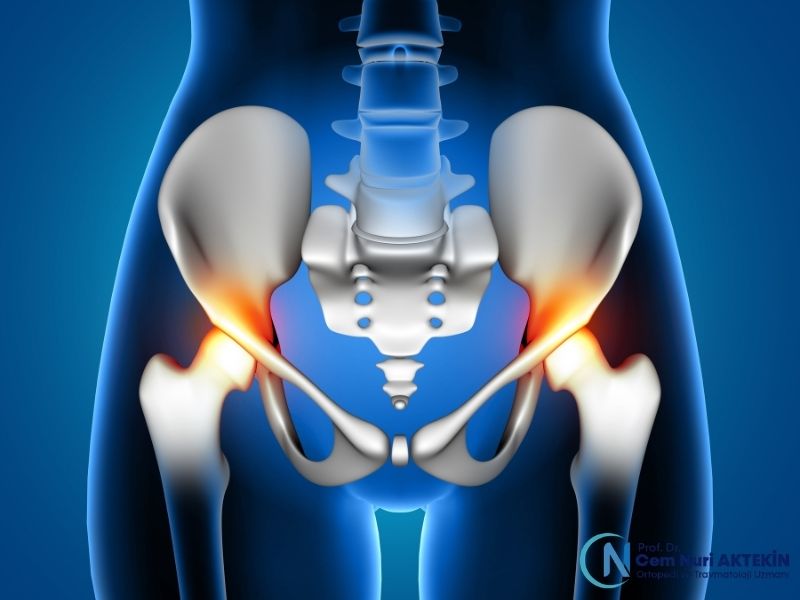 kalca-kireclenmesine-ne-iyi-gelir