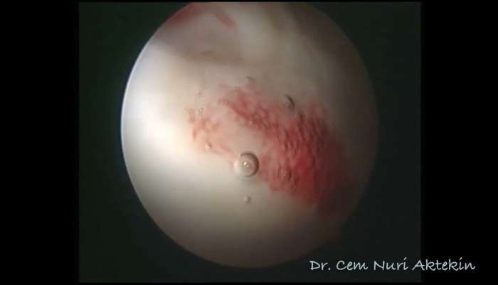 video,paylaşım,kameralı telefon,videofon,ücretsiz,yükleme