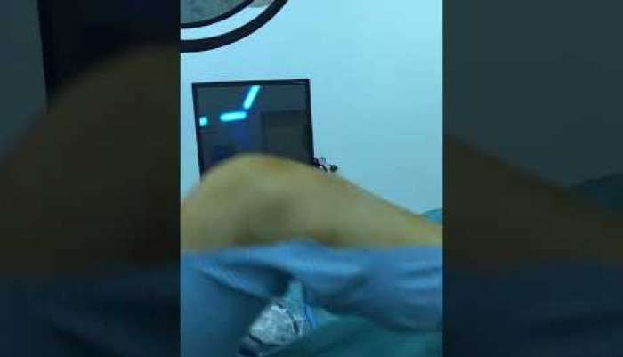 ameliyat öncesi ön çapraz bağ yırtıklı hastanın muayenesi